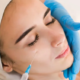 Choosing a Safe Botox Provider for Cosmetic Procedures